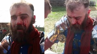 Terrible brutal injury in the battle of the knights! Buhurt almost ended in the loss of an eye!