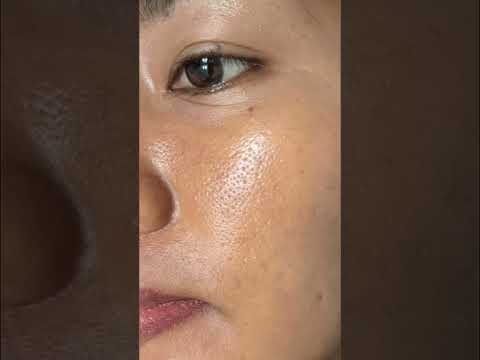   مشاكل بشره وشعر قوليلي عليها وانا ارد عليكم في اسرع وقت