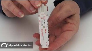 Faecal Immunochemical Test (FIT) Sampling Instructions