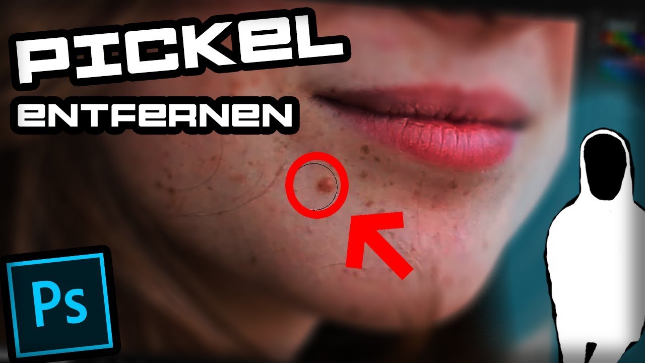 Pickel Gesicht Entfernen Pickel Gesicht Entfernen