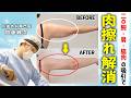 【53歳・脂肪吸引】何をしても落ちなかった二の腕、1,000cc取った3ヶ月後がこちら
