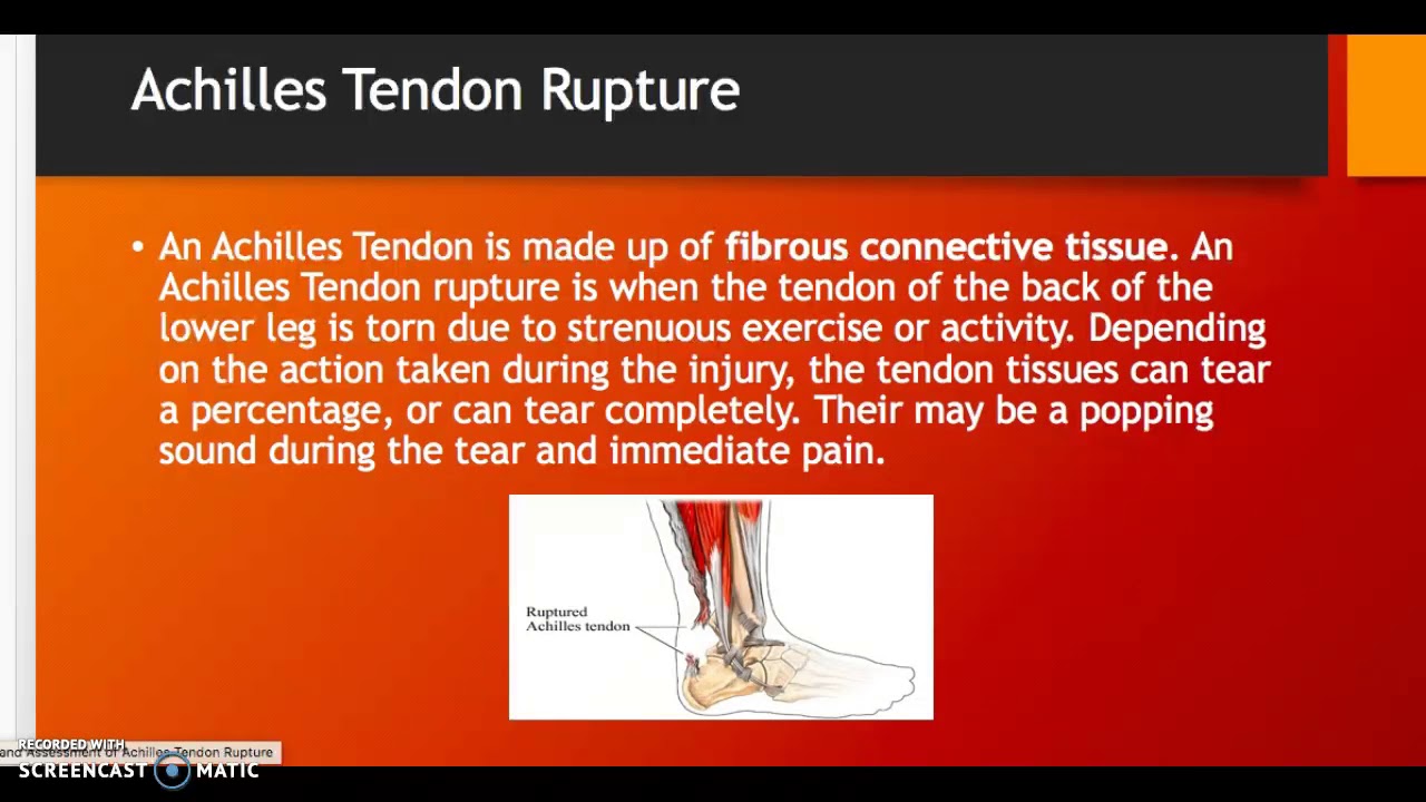 Critical analysis essay picture