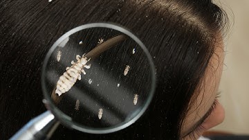 How to Clean your House of Lice : Effective Household Cleaning to Eliminate Lice
