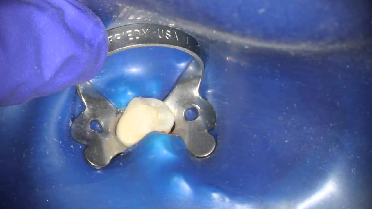 Dr. Shawn Velez Tips on Rubber Dam placement Dentsply Sirona YouTube