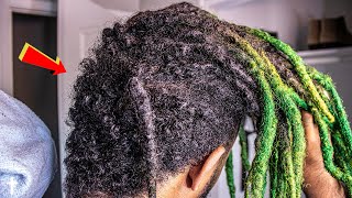 Dreadlocks "UGLY STAGE" Makes You Quit?