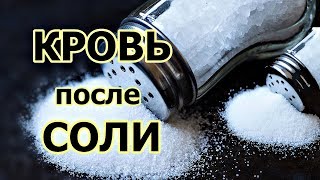 картинка: Кровь после соли. Важная информация