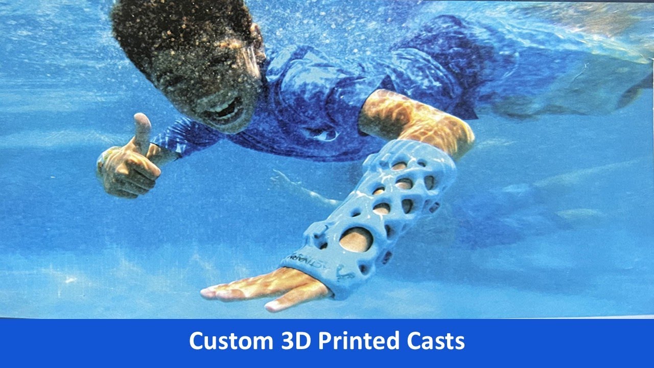 Custom 3D Printed Casts with Diana Hall of ActivArmor