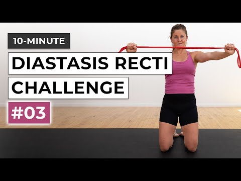 10-Minute Diastasis Recti Challenge (#3)