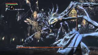 Bloodborne: Amygdala - Pthumerian Defilement Layer 3 @BioHazard4Live