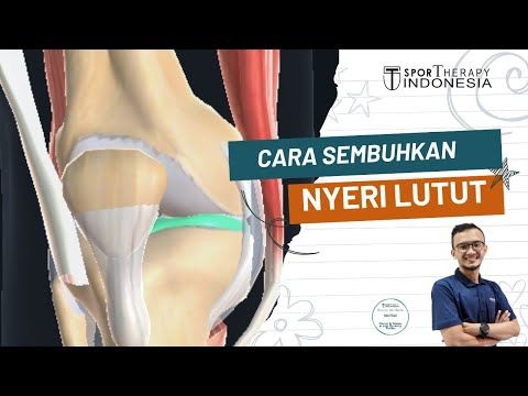 Video: Meniskus Lateral Sendi Lutut - Sebab, Gejala, Diagnosis Dan Rawatan