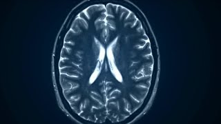 Doctor gets TMS approved for teens
