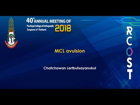 RCOST2018 : MCL avulsion