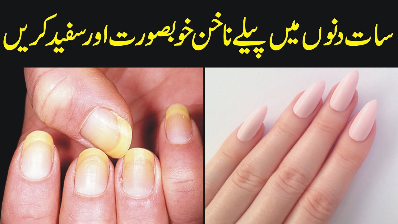 Remedy For Strong And Shiny Nails|How To Remove Yellow Stain From Nails|Nail  Tips In Urdu - YouTube