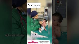 White patches in oral cavity of a newborn | oral thrush #newborn #babyvideos #ytshorts #drlavanya