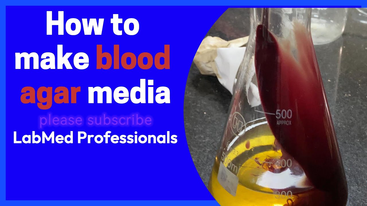 কিভাবে ব্লাড আগার মিডিয়া তৈরি করবেন। how to make blood agar media 2024