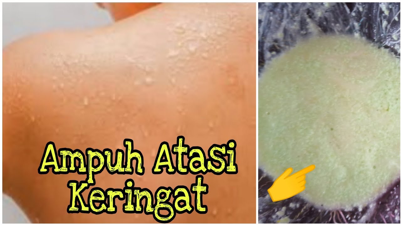 Punya Keringat Berlebih 8 Hal Ini Bisa Jadi Faktor