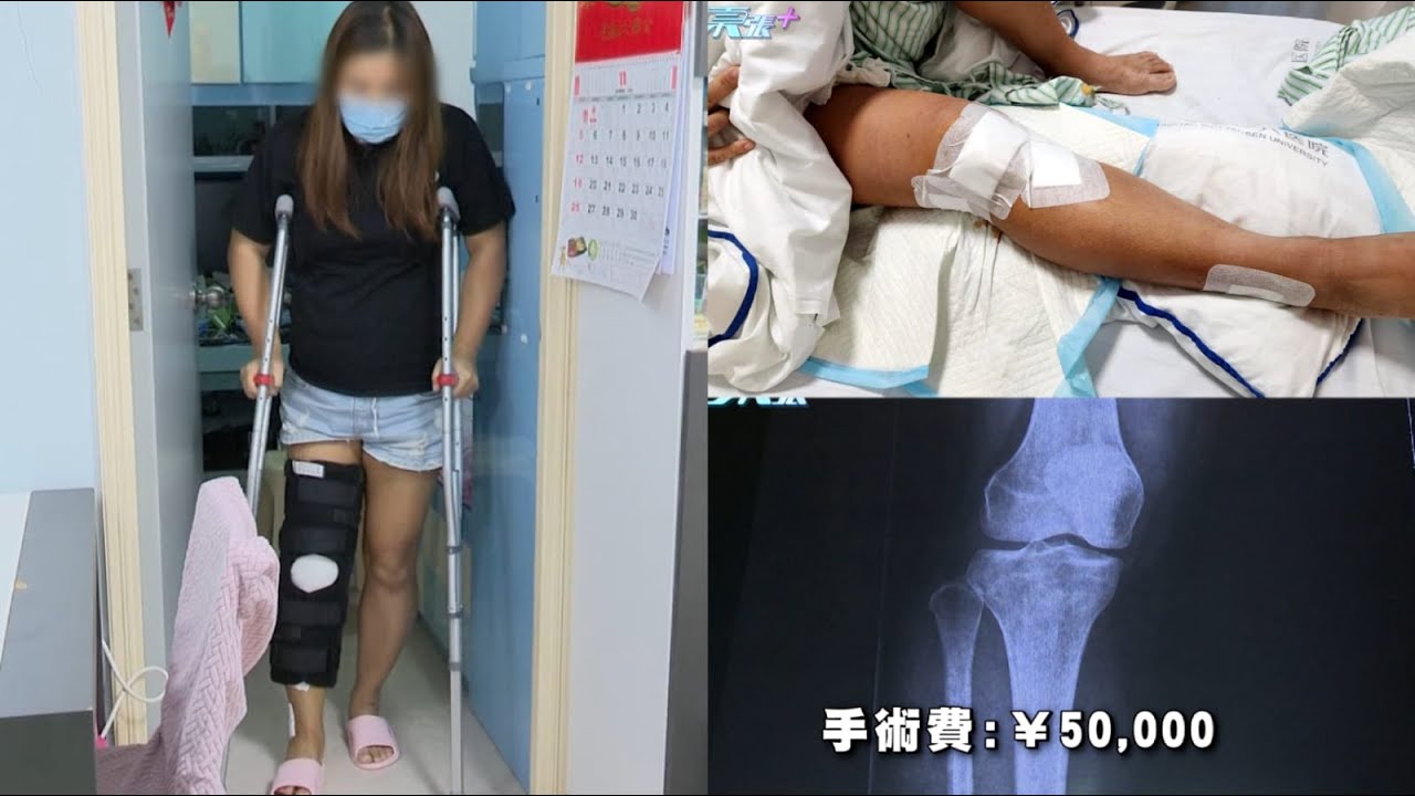 港女深圳水療跌致韌帶撕裂水療中心只肯負責一半醫療費用