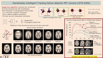 OHBM 2024 | Oral Session | Yasuomi Ouchi |  Imaging the brain during coughing: a unique PET study …