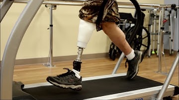 3D Print Prosthetic Sockets in 45 - 90 Minutes