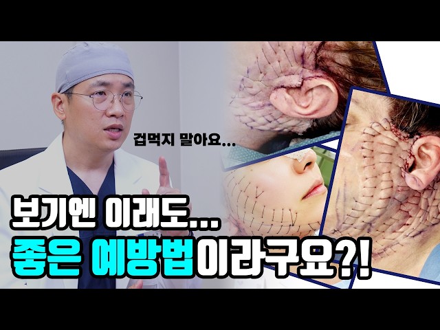 해외에서 화제가 된 안면거상술?! 이건 수술이 아닙니다!