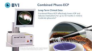 Basics of ECP performed with Phacoemulsification screenshot 1