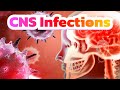 Meningitis and CNS Infections (updated 2023) - CRASH! Medical Review Series