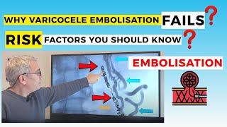 Varicocele Embolisation Failure: What Are the Possible Risk Factors?