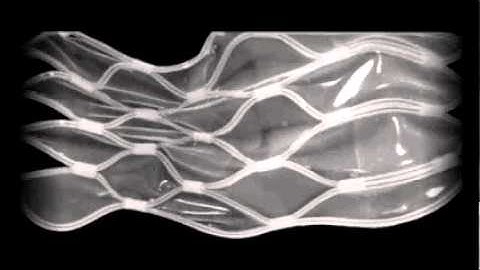 SKiN I Surface Change 2