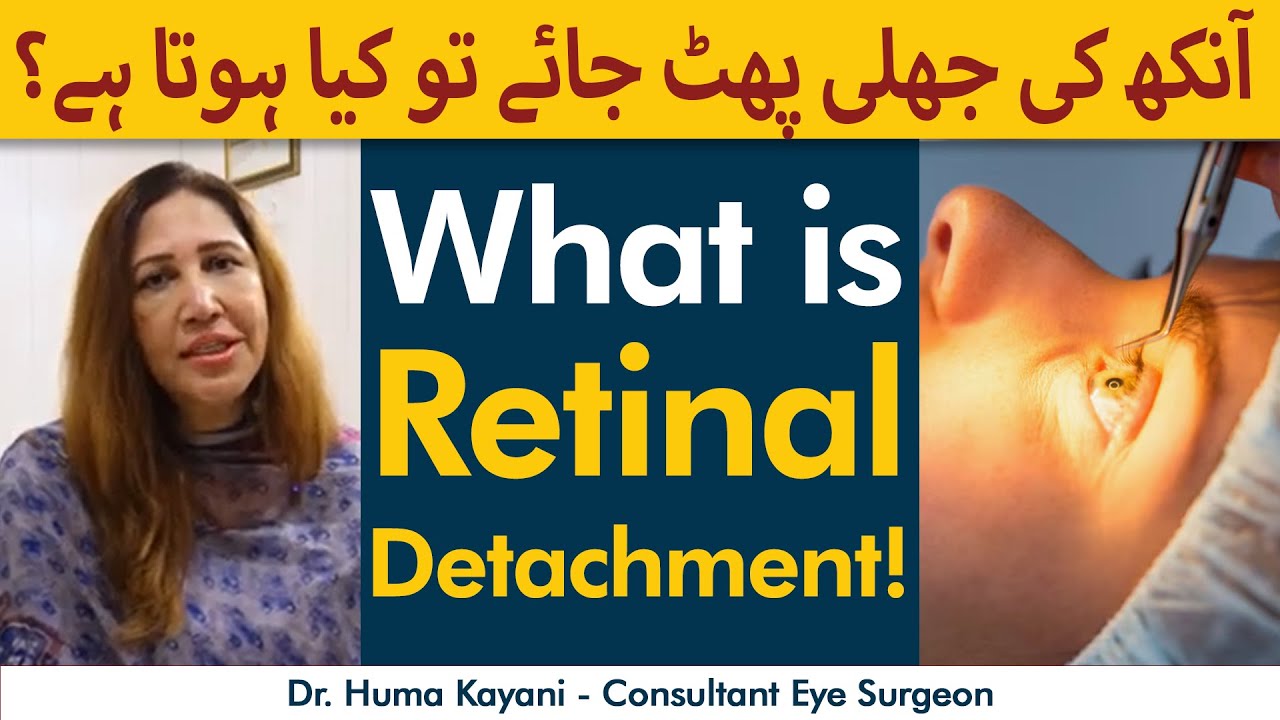 What Is Retinal Detachment Aankh Ka Parda Fat Jaye To Kya Hota Hai