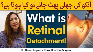 What Is Retinal Detachment | Aankh Ka Parda Fat Jaye To Kya Hota Hai