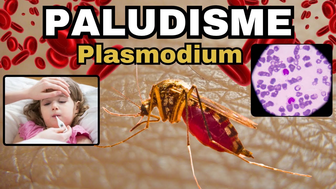 Tout savoir sur le PALUDISME - MALARIA : Plasmodium, Cycle, Diagnostic,  Traitement