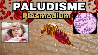 Tout savoir sur le PALUDISME - MALARIA : Plasmodium, Cycle, Diagnostic, Traitement