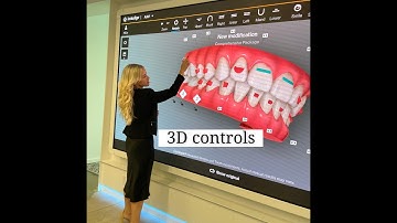 ClinCheck for Invisalign - 3D Controls