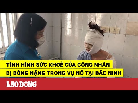 Video Tình hình sức khoẻ của công nhân bị bỏng nặng trong vụ... - youtube