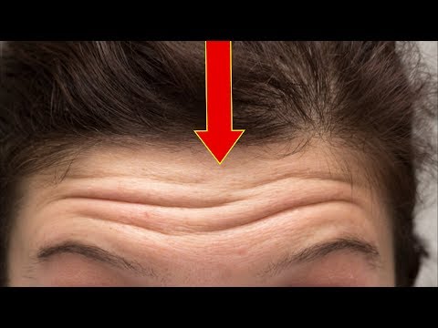 क्या आपके माथे पर ऐसी रेखाएं बनती है? Forehead Lines meaning