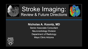 Stroke Imaging: Review and Future Directions