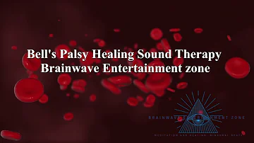 Bell's Palsy Treatment & Healing Binaural Beats Sound Therapy | Facial Paralysis Treatment Pure Tone