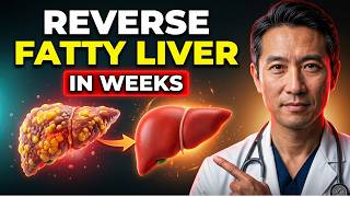 The FASTEST Way to Reverse Fatty Liver, Naturally | NAFLD Treatment