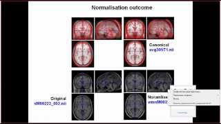 Famous SPM12 (Kyiv 2015): part 6 - normalisation 2/3 Profile