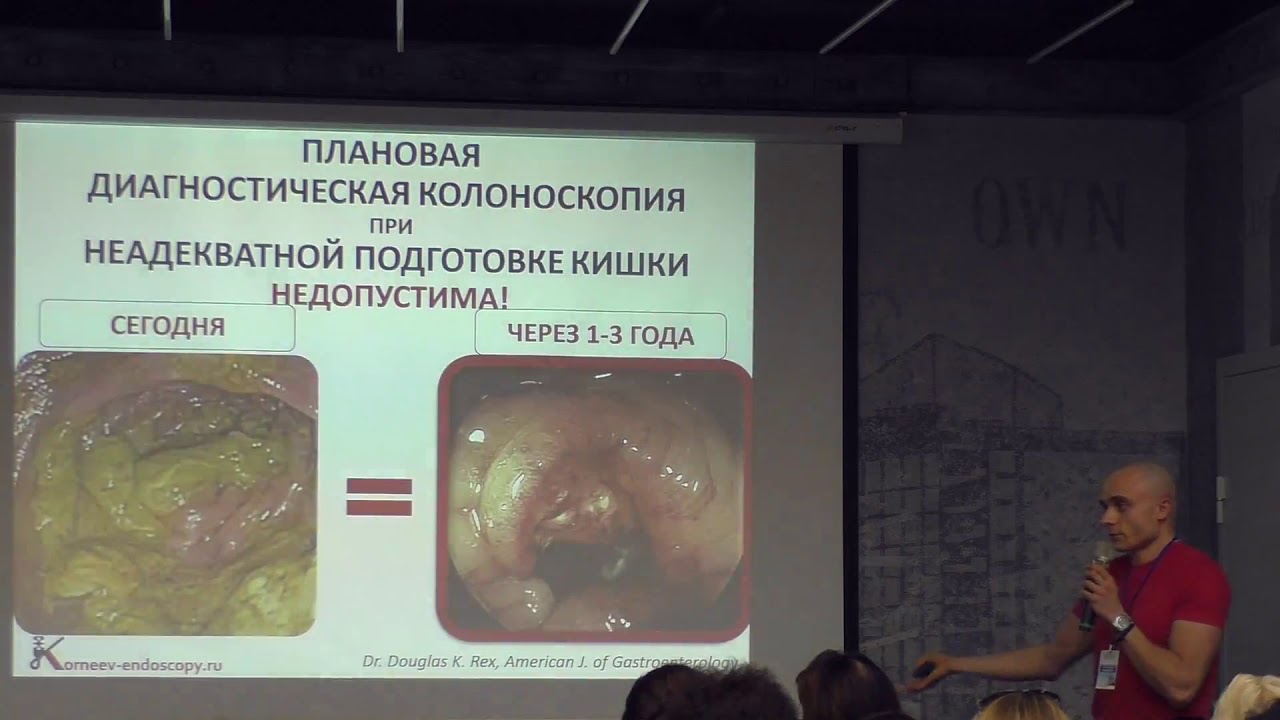 Схема оценки качества подготовки толстой кишки по бостонской шкале