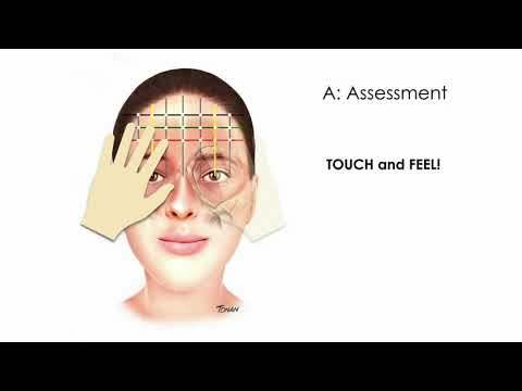 One21 forehead injection with incobotulinumtoxinA - Video abstract [ID 237519]