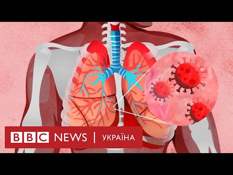 Як і кого може вбити коронавірус