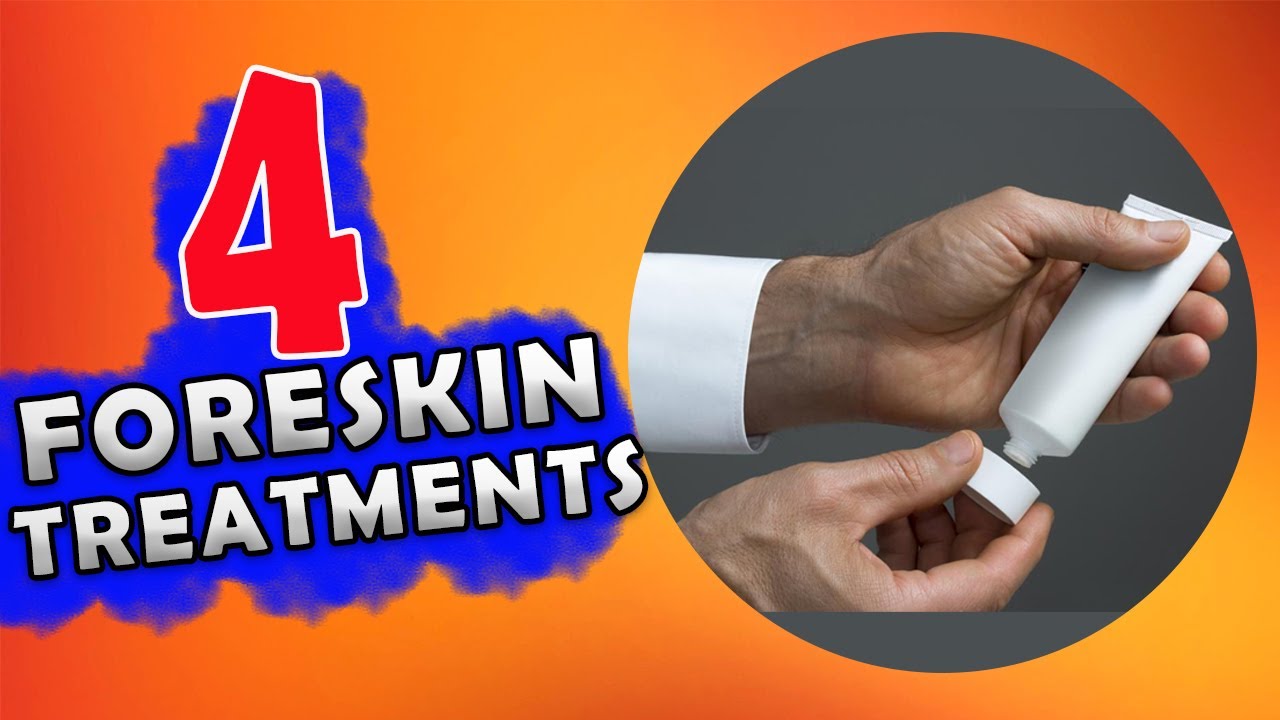 #3 Fix Your Foreskin: 4 Common Treatment For Phimosis (Tight Foreskin)