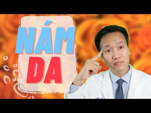 NÁM DA - 5 Tiêu chí quan trọng trong trị nám | Dr Hiếu