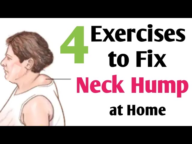 Got a Hump In Your Neck? Here Are Some Tricks to Fix It: Glaser