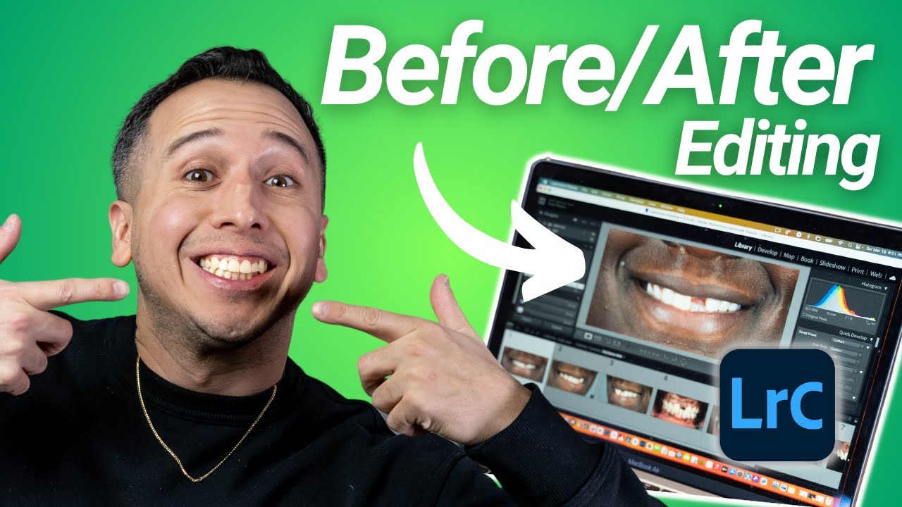 how-to-edit-dental-photos-part-iii-exporting-and-importing-into-canva
