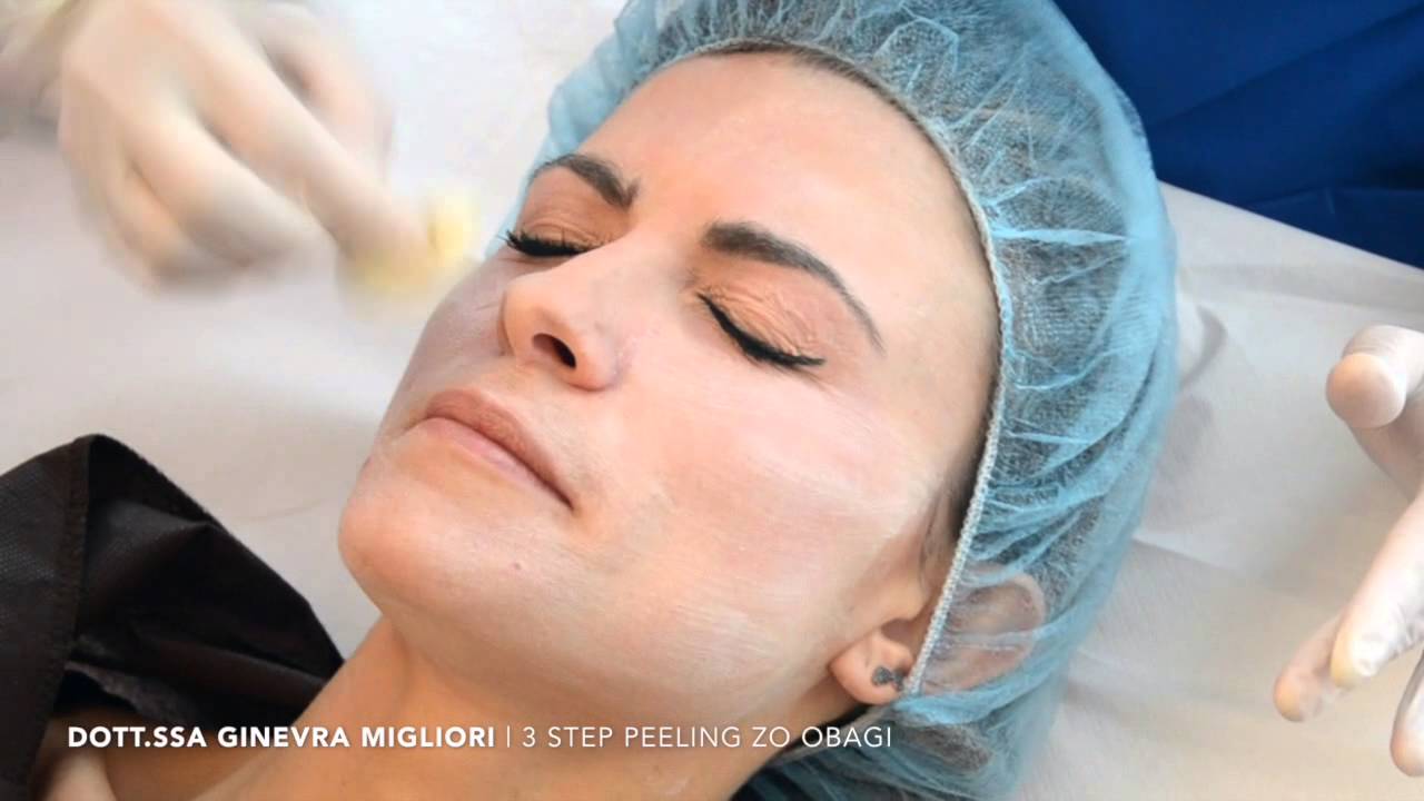 peeling chimico per macchie viso