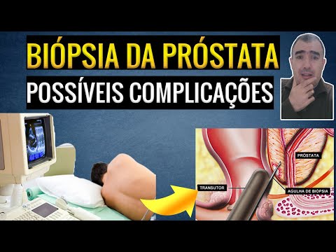 Vídeo: Alternativas Para Biópsia Da Próstata: Compreenda Suas Opções