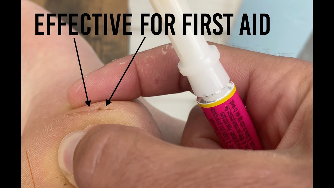 ★★★★★ Super Glue for First Aid: "Plastic Surgery" Super Glue review on Amazon