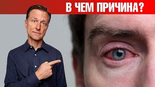 Красные Глаза, Зуд, Чувствительность К Свету 👉 Главная Причина!